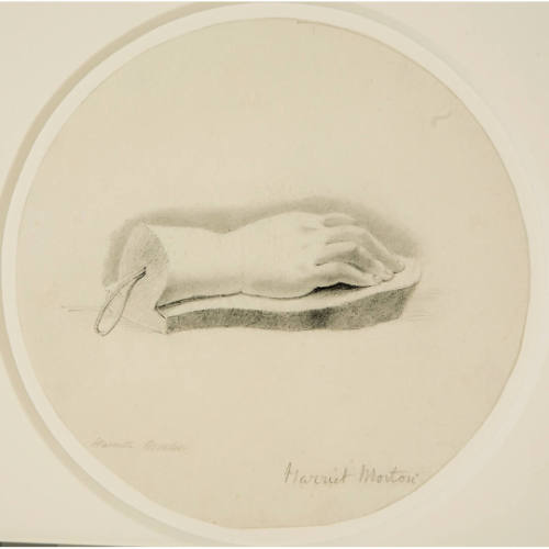 Drawing of Right Hand Plaster Cast